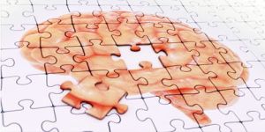 Il MODA: la batteria italiana per valutare l'Alzheimer