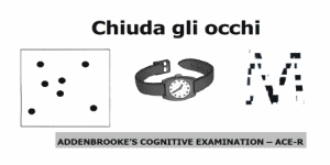 ADDENBROOKE'S COGNITIVE EXAMINATION- revised (ACE-R versione italiana): un utile sostituzione del MMSE
