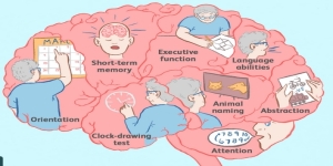 Il MOntreal Cognitive Assessment (MoCA): quante versioni esistono?